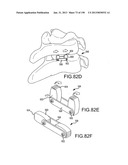 VERTEBRAL JOINT IMPLANTS AND DELIVERY TOOLS diagram and image