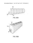 VERTEBRAL JOINT IMPLANTS AND DELIVERY TOOLS diagram and image