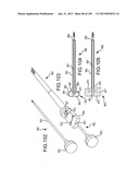 VERTEBRAL JOINT IMPLANTS AND DELIVERY TOOLS diagram and image