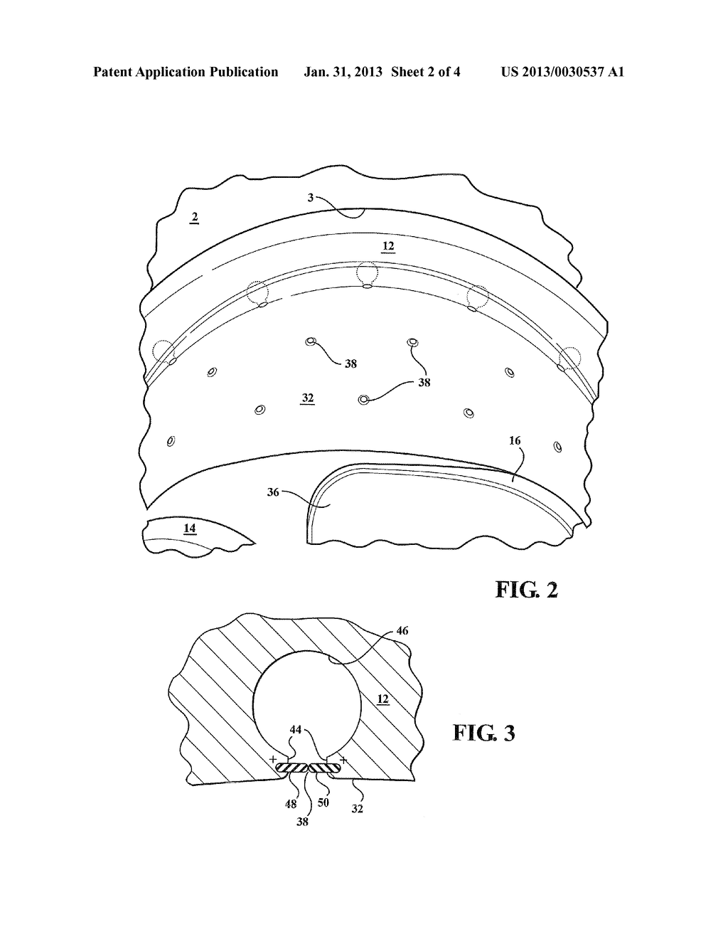 IMPLANTABLE JOINT ASSEMBLY FEATURING DEBRIS ENTRAPMENT CHAMBER     SUBASSEMBLIES ALONG WITH OPPOSING MAGNETIC FIELDS GENERATED BETWEEN     ARTICULATING IMPLANT COMPONENTS IN ORDER TO MINIMIZE FRICTIONAL FORCE AND     ASSOCIATED WEAR - diagram, schematic, and image 03