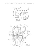 Method And Apparatus For Positioning A Multiple Piece Prosthesis diagram and image