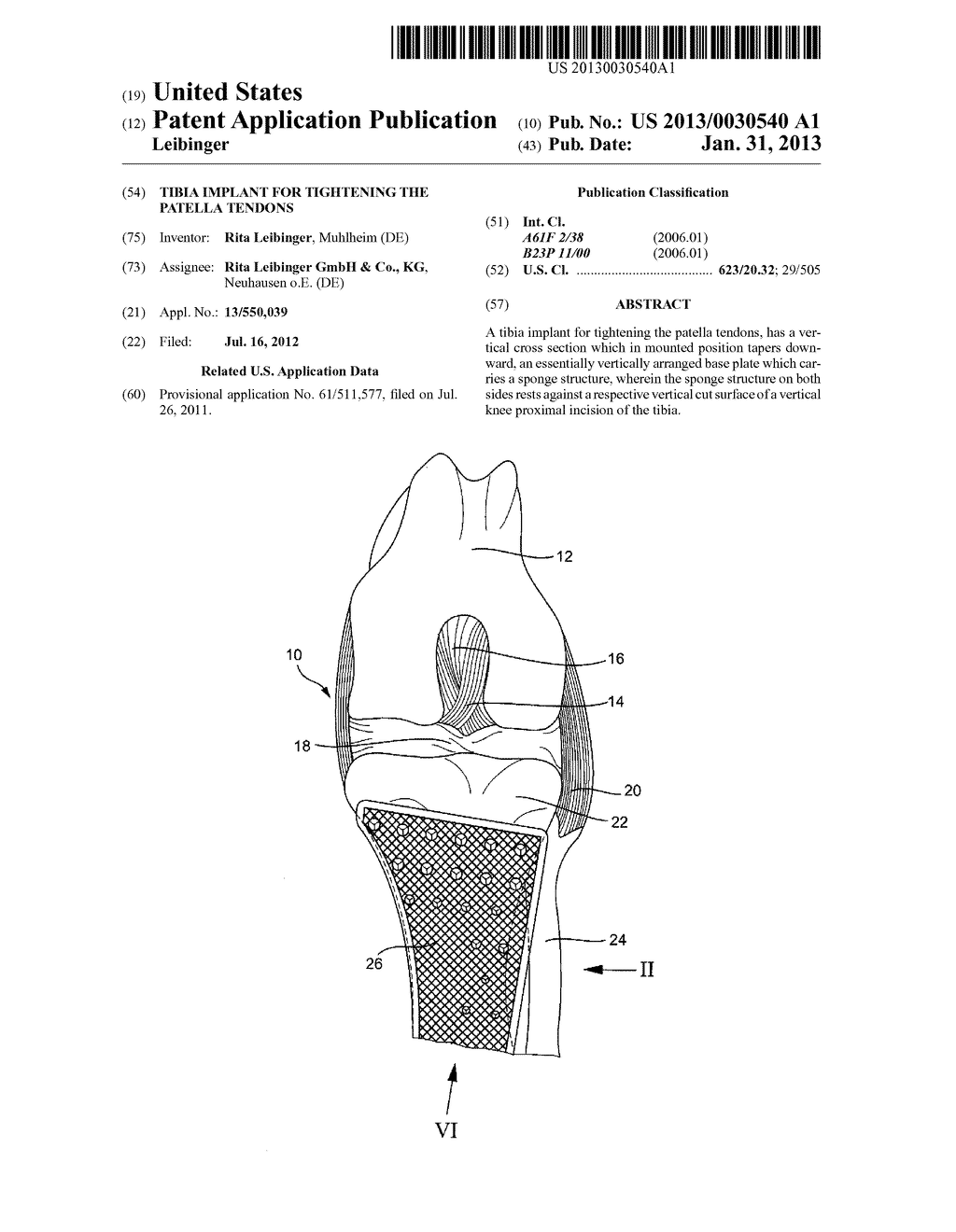 TIBIA IMPLANT FOR TIGHTENING THE PATELLA TENDONS - diagram, schematic, and image 01