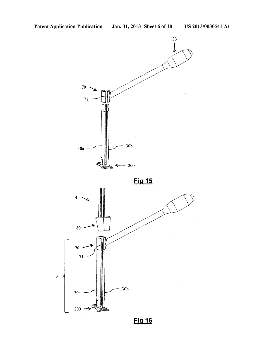 DEVICE FOR POSITIONING AN IMPLANT - diagram, schematic, and image 07