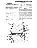 RESILIENT KNEE IMPLANT AND METHODS diagram and image