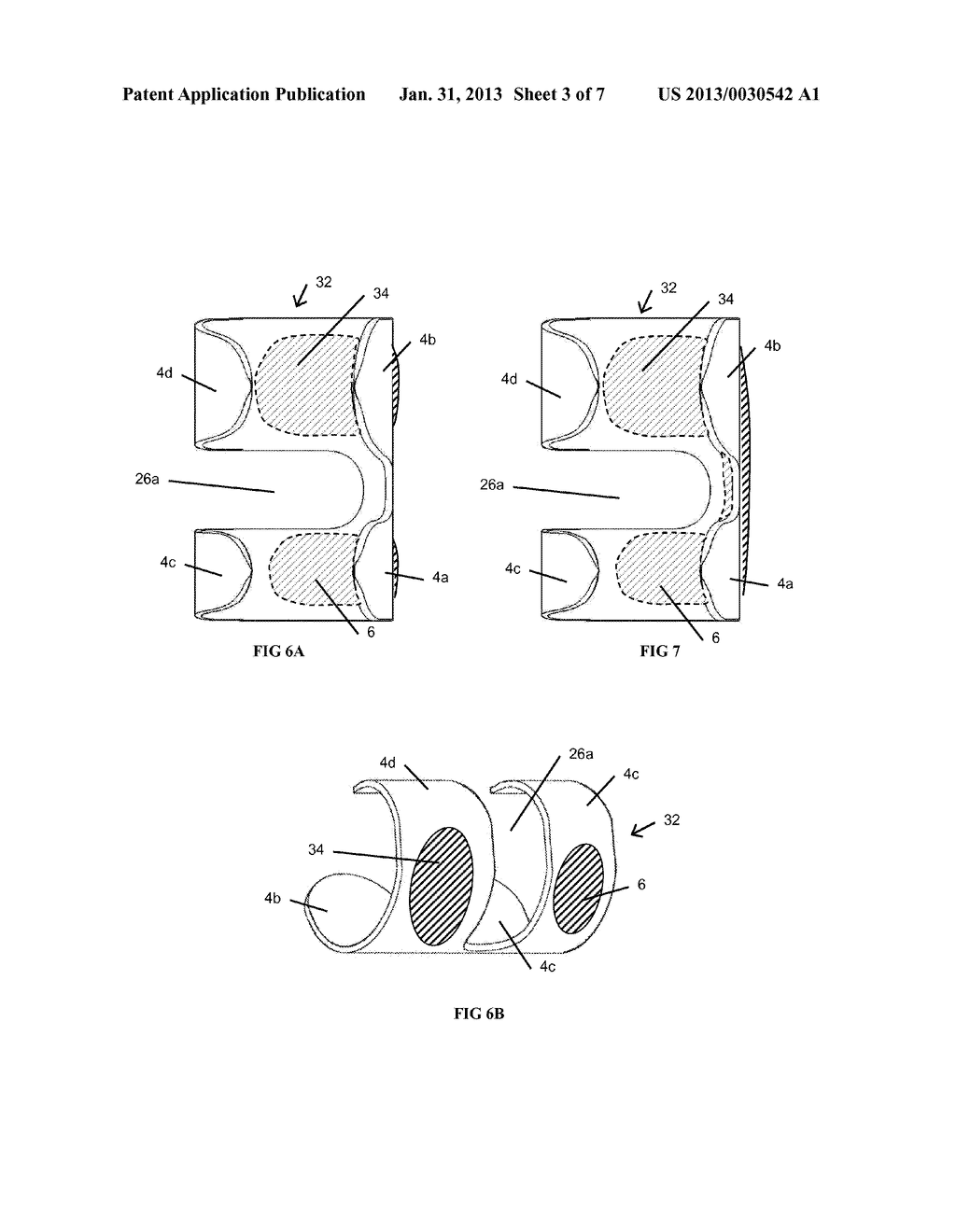 RESILIENT KNEE IMPLANT AND METHODS - diagram, schematic, and image 04