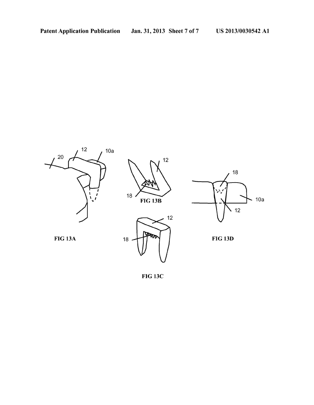 RESILIENT KNEE IMPLANT AND METHODS - diagram, schematic, and image 08