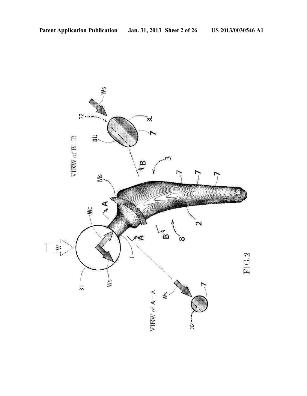 Stem Structure For Composite Prosthetic Hip And Method For Manufacturing     The Same - diagram, schematic, and image 03