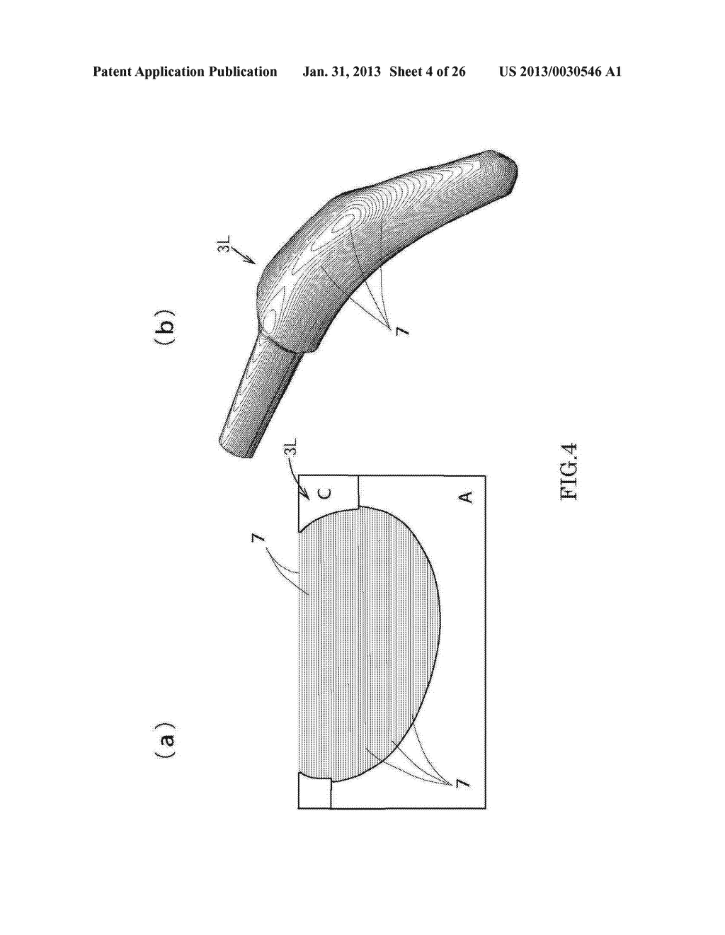 Stem Structure For Composite Prosthetic Hip And Method For Manufacturing     The Same - diagram, schematic, and image 05