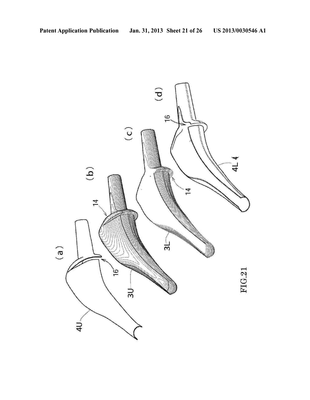 Stem Structure For Composite Prosthetic Hip And Method For Manufacturing     The Same - diagram, schematic, and image 22