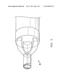 Composite Bone Graft Kit diagram and image