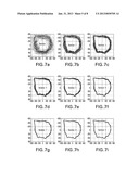 PRECISE BOREHOLE GEOMETRY AND BHA LATERAL MOTION BASED ON REAL TIME     CALIPER MEASUREMENTS diagram and image