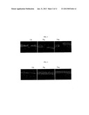 MODEL SYSTEM OF ACANTHAMOEBA KERATITIS SYNDROME AND METHOD FOR SELECTING A     TREATMENT THEREOF diagram and image