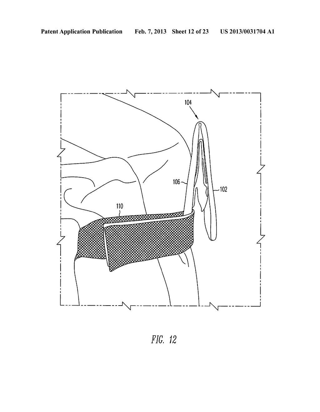 Knee-Mounted Air Deflector For Motorcyclist - diagram, schematic, and image 13