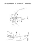 Braided Para cord Devices with Tools Contained Therein diagram and image