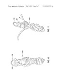 Braided Para cord Devices with Tools Contained Therein diagram and image