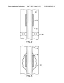 SYSTEM AND METHOD FOR DISSIPATION OF AN EFFECT OF A TUBE WAVE diagram and image