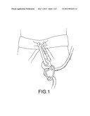 ASSISTED SAFETY LOCKING DEVICE EQUIPPED WITH ANTI-PANIC DEVICE diagram and image