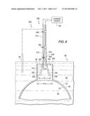 ELECTRODE CONFIGURATIONS FOR COATING INTERIOR AND EXTERIOR SURFACES OF     CONDUCTIVE SUBSTRATES IN AN ELECTRODEPOSITION COATING PROCESS diagram and image