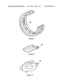 VALVE HAVING AN ELASTOMER/CERAMIC SEALING RING diagram and image