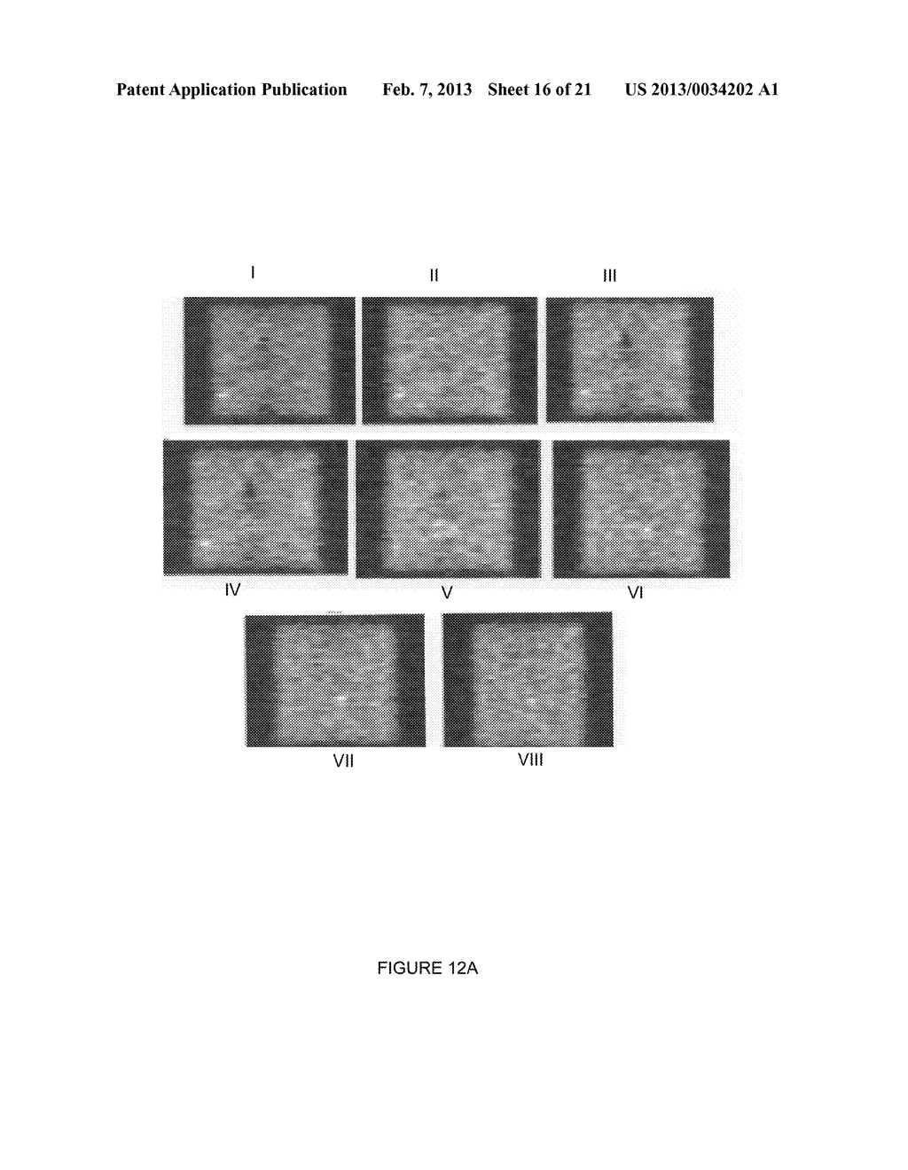 OPPOSED VIEW AND DUAL HEAD DETECTOR APPARATUS FOR  DIAGNOSIS AND BIOPSY     WITH IMAGE PROCESSING METHODS - diagram, schematic, and image 17