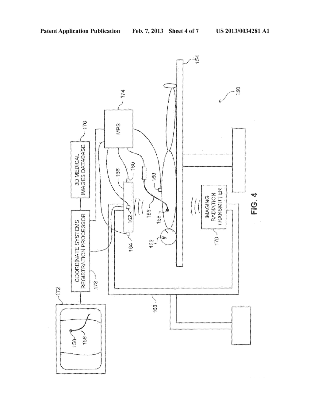 Method and a system for registering a 3D pre-acquired image coordinates     system with a medical positioning system coordinate system and with a 2D     image coordinate system - diagram, schematic, and image 05