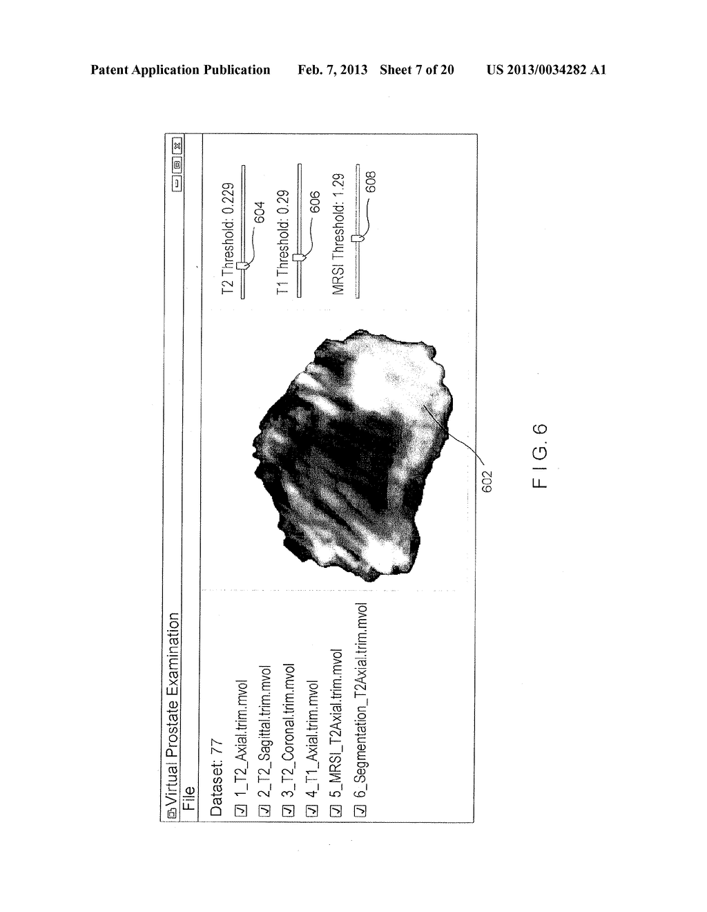 SYSTEM AND METHOD FOR PROSTATE VISUALIZATION AND CANCER DETECTION - diagram, schematic, and image 08