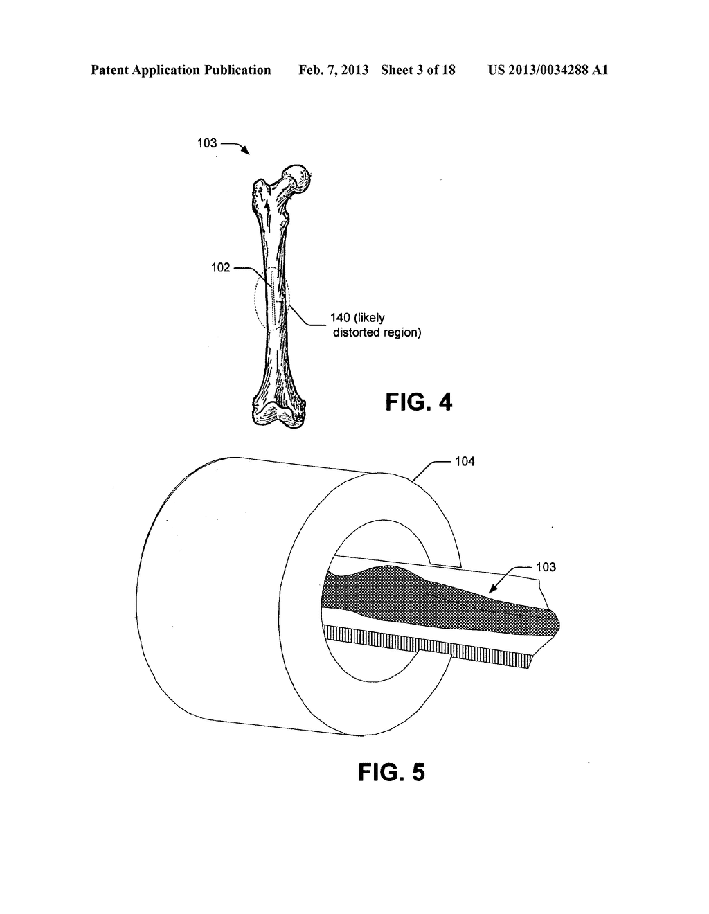 DISTORTION COMPENSATED IMAGING - diagram, schematic, and image 04