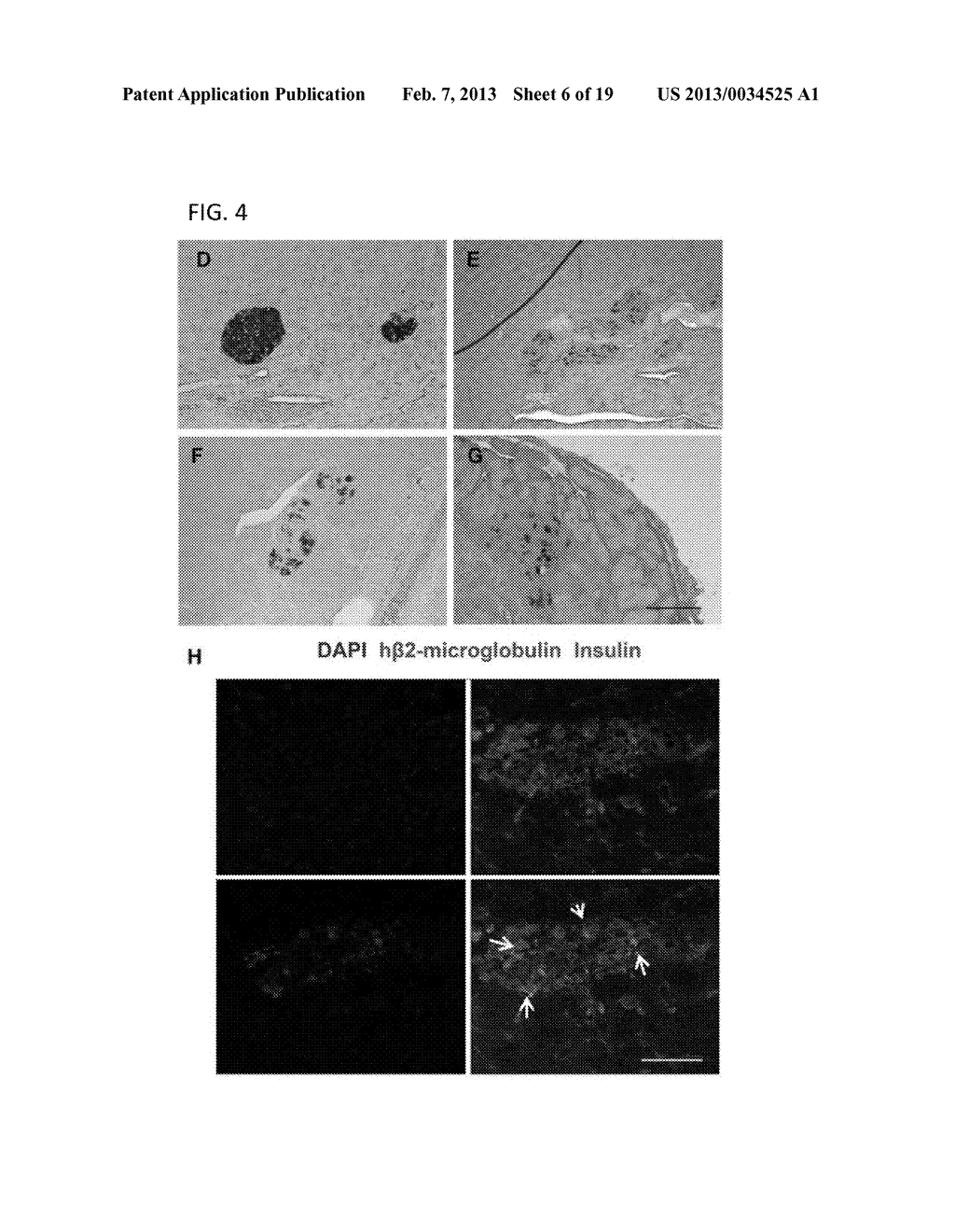 BETA ISELETS-LIKE CELLS DERIVED FROM WHOLE BONE MARROW - diagram, schematic, and image 07