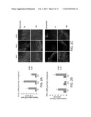 POPULATIONS OF PANCREATIC PROGENITOR CELLS AND METHODS OF ISOLATING AND     USING SAME diagram and image