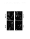 POPULATIONS OF PANCREATIC PROGENITOR CELLS AND METHODS OF ISOLATING AND     USING SAME diagram and image