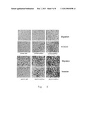 EPIDERMAL GROWTH FACTOR RECEPTOR VARIANT diagram and image