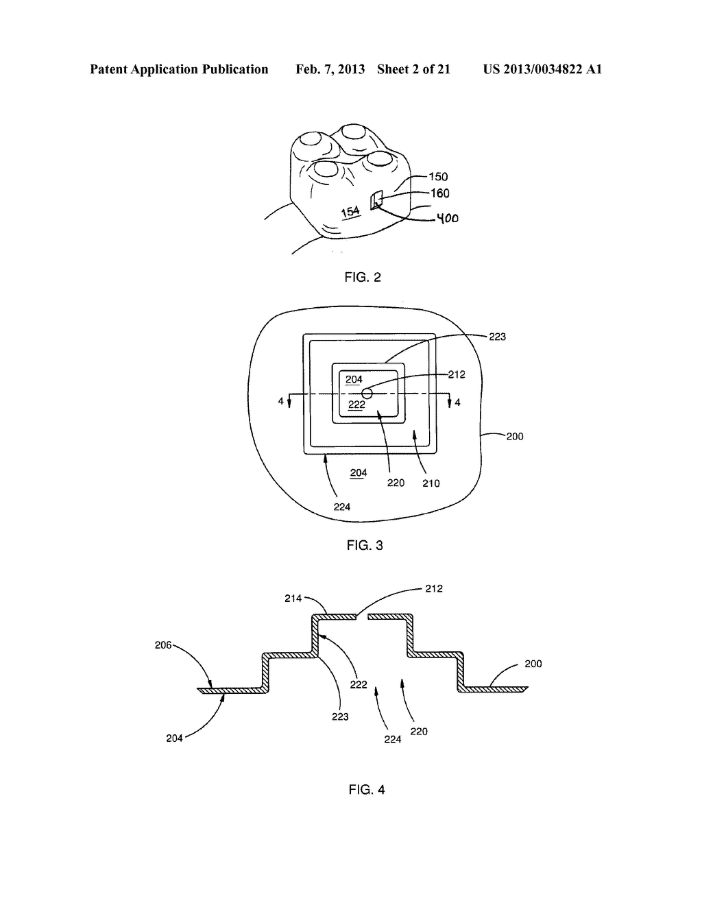 ORTHODONTIC ATTACHMENT DEVICE SYSTEMS AND METHODS - diagram, schematic, and image 03