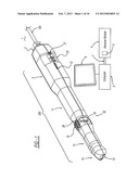 Intraoral Imaging System diagram and image