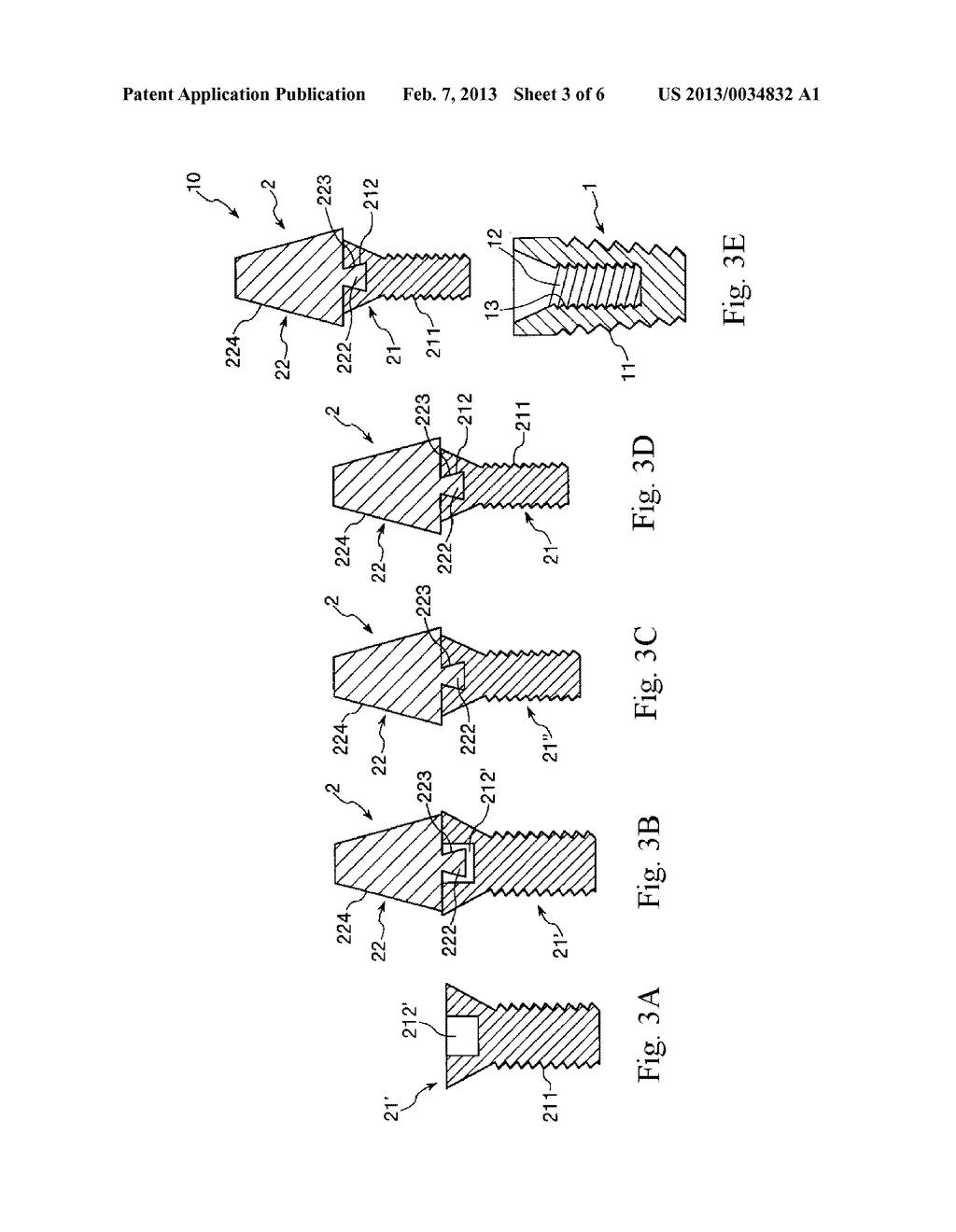 Method for Manufacturing Dental Implant and Dental Implant - diagram, schematic, and image 04