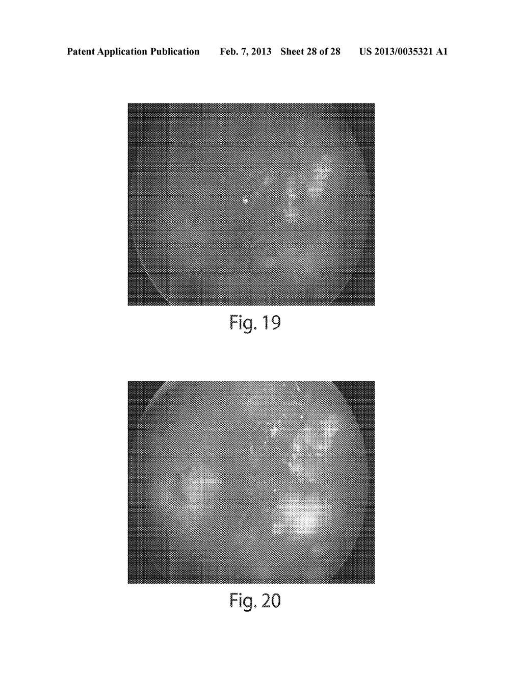 COMPOUNDS FOR THE TREATMENT OF OCULAR CANCER - diagram, schematic, and image 29