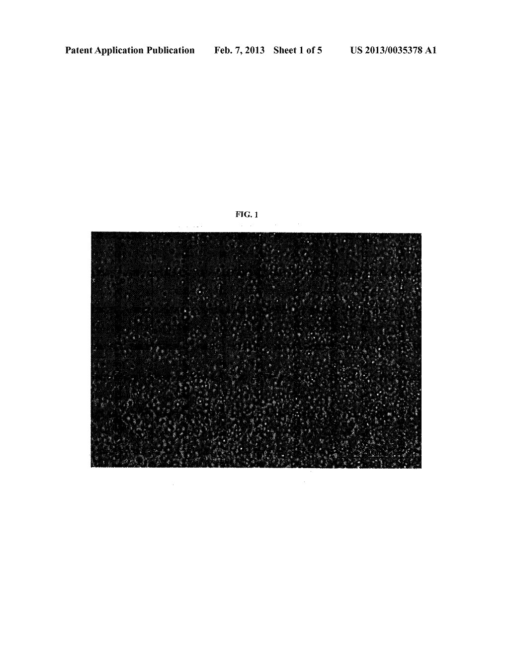 FILM DELIVERY SYSTEM FOR TETRAHYDROLIPSTATIN - diagram, schematic, and image 02