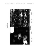 FILM DELIVERY SYSTEM FOR TETRAHYDROLIPSTATIN diagram and image