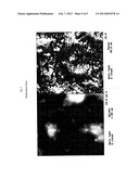 FILM DELIVERY SYSTEM FOR TETRAHYDROLIPSTATIN diagram and image