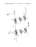 ROBOTIC SYSTEMS AND METHODS FOR TREATING TISSUE diagram and image