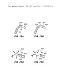 ROBOTIC SYSTEMS AND METHODS FOR TREATING TISSUE diagram and image