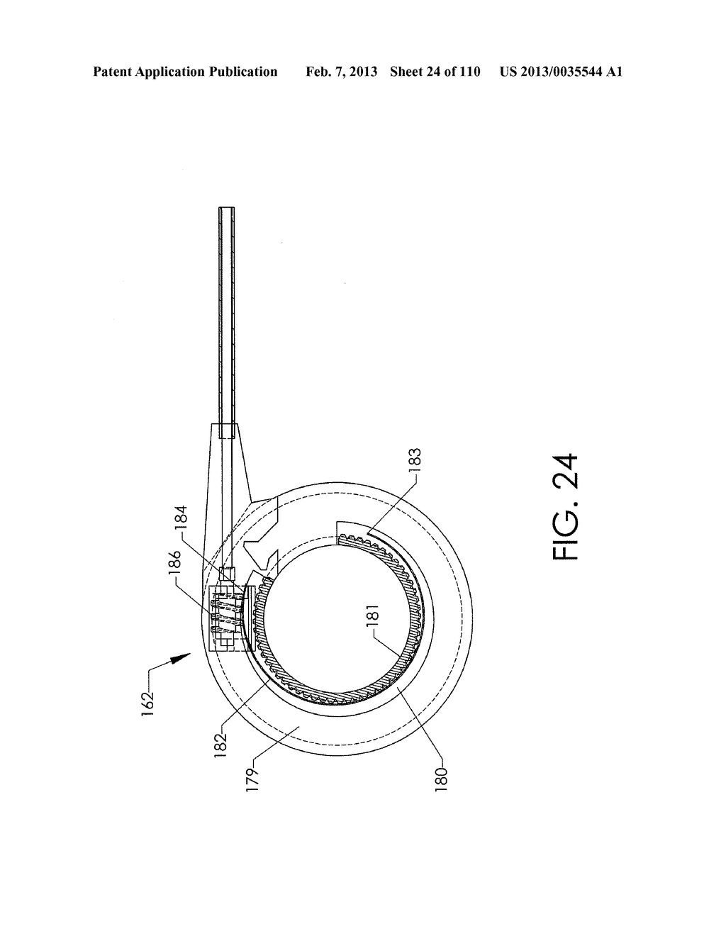 ADJUSTABLE IMPLANT AND METHOD OF USE - diagram, schematic, and image 25