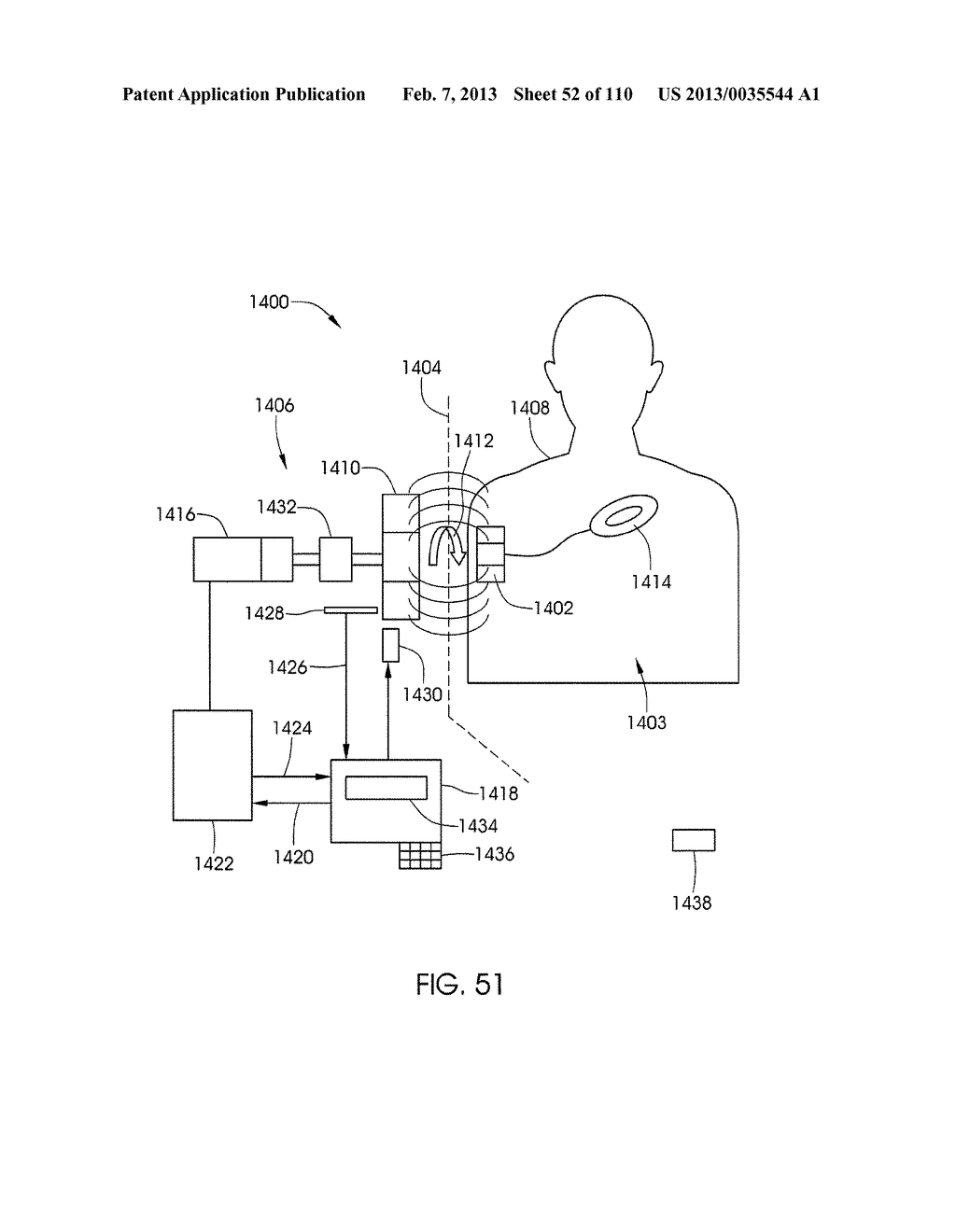 ADJUSTABLE IMPLANT AND METHOD OF USE - diagram, schematic, and image 53