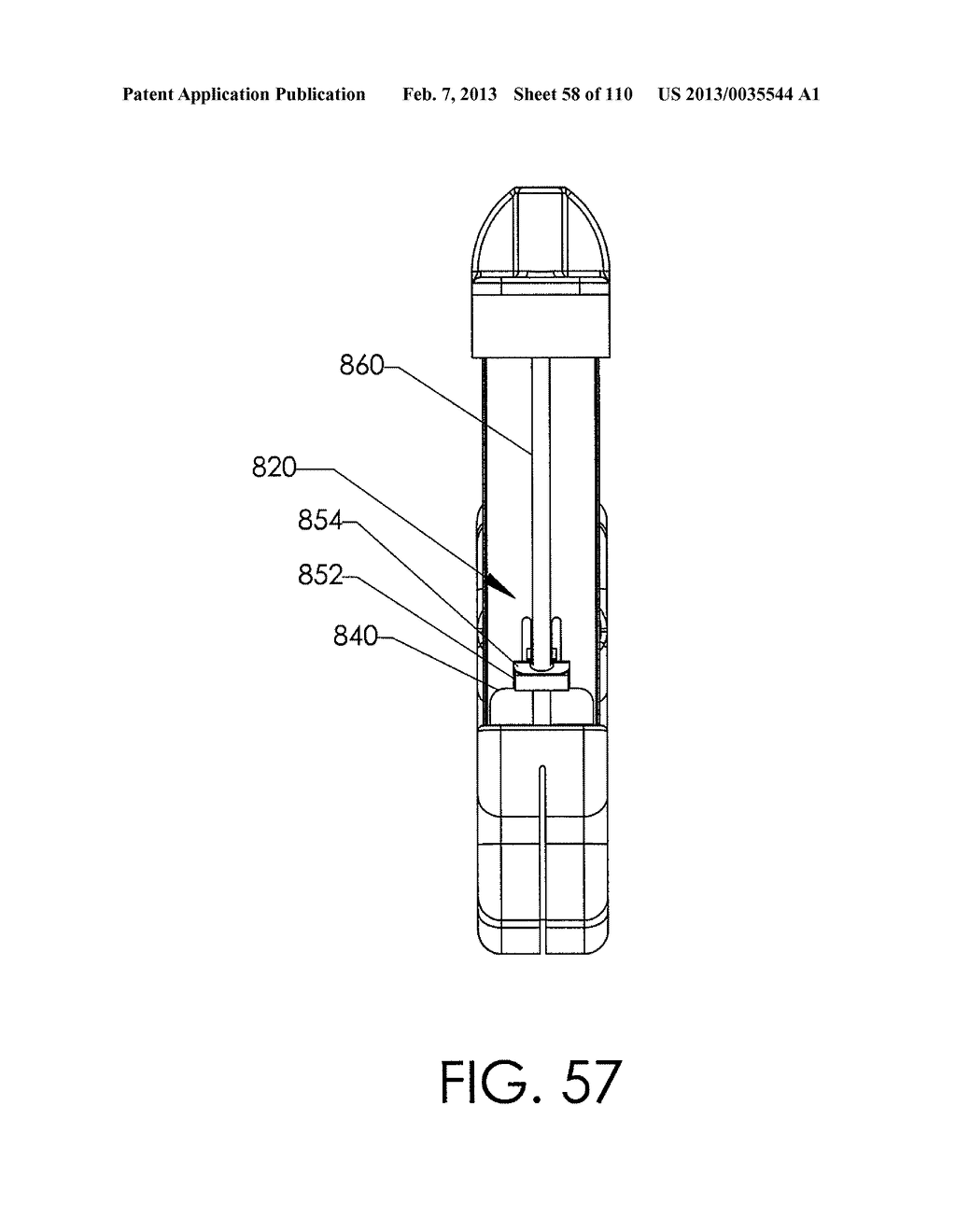 ADJUSTABLE IMPLANT AND METHOD OF USE - diagram, schematic, and image 59