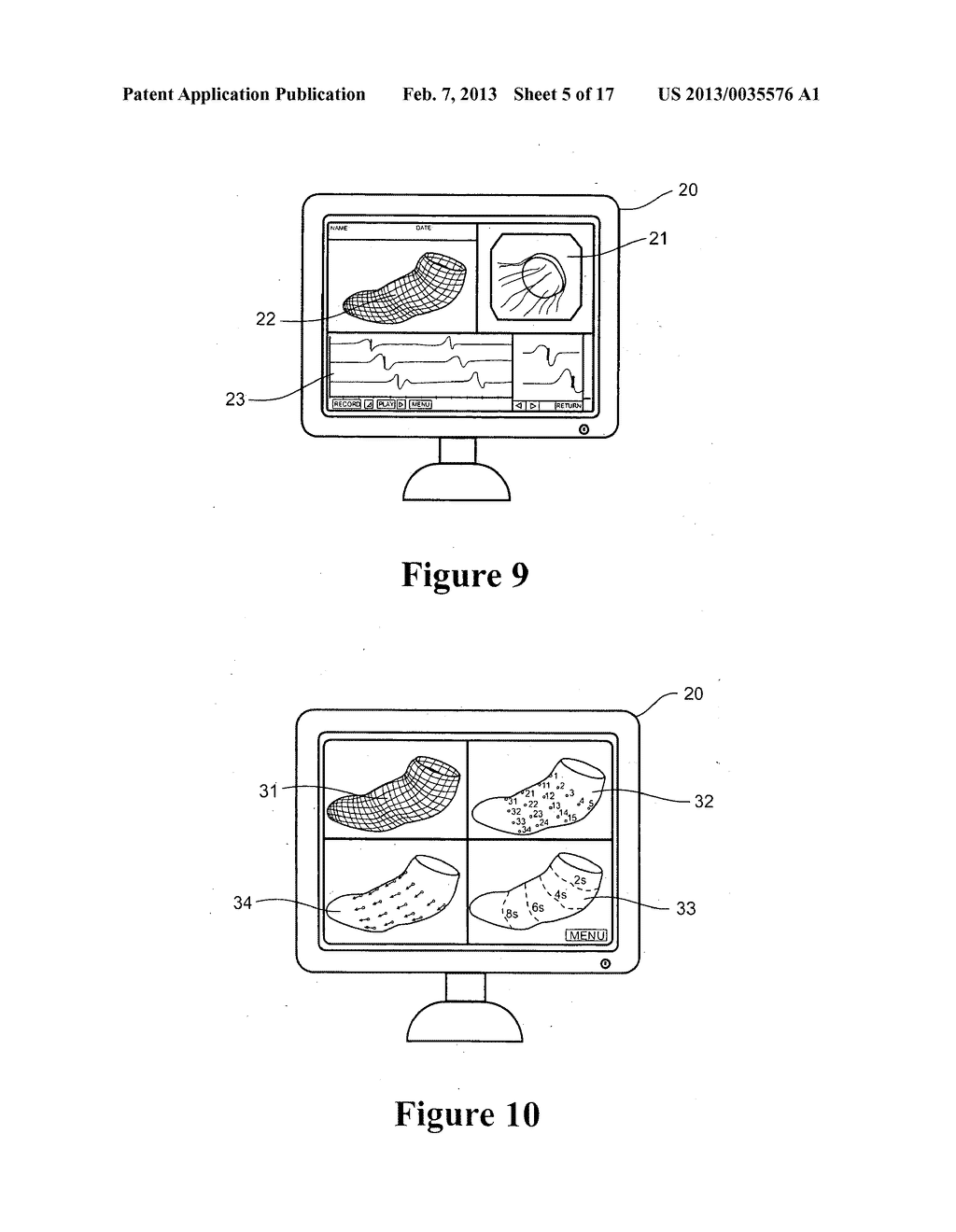 SYSTEM AND METHOD FOR MAPPING GASTRO-INTESTINAL ELECTRICAL ACTIVITY - diagram, schematic, and image 06