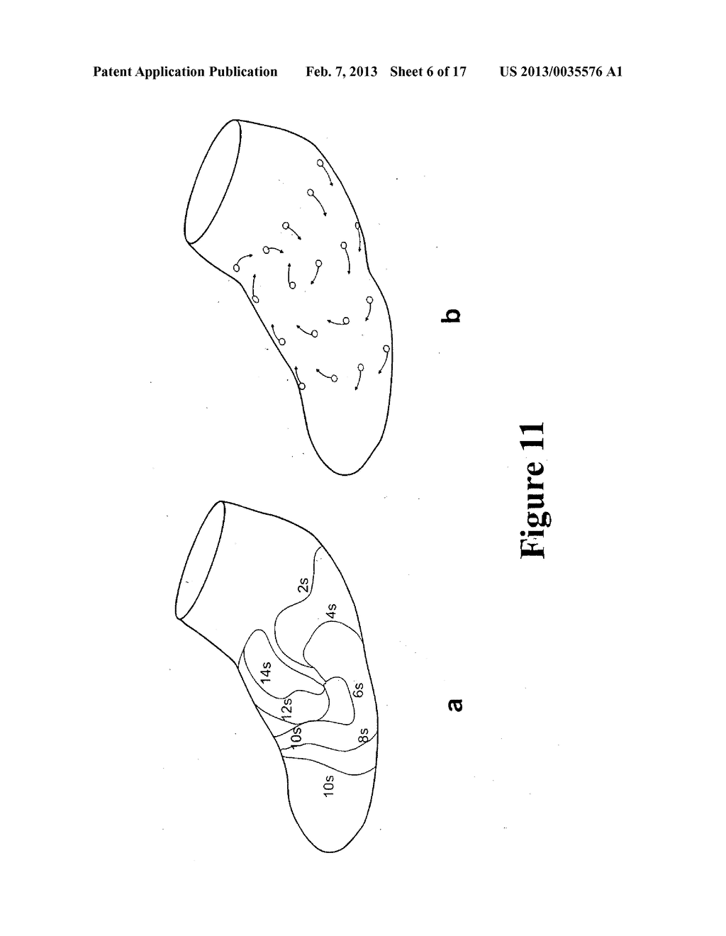 SYSTEM AND METHOD FOR MAPPING GASTRO-INTESTINAL ELECTRICAL ACTIVITY - diagram, schematic, and image 07