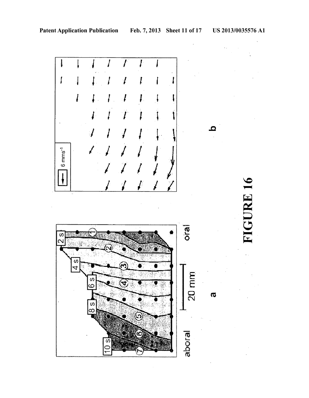 SYSTEM AND METHOD FOR MAPPING GASTRO-INTESTINAL ELECTRICAL ACTIVITY - diagram, schematic, and image 12