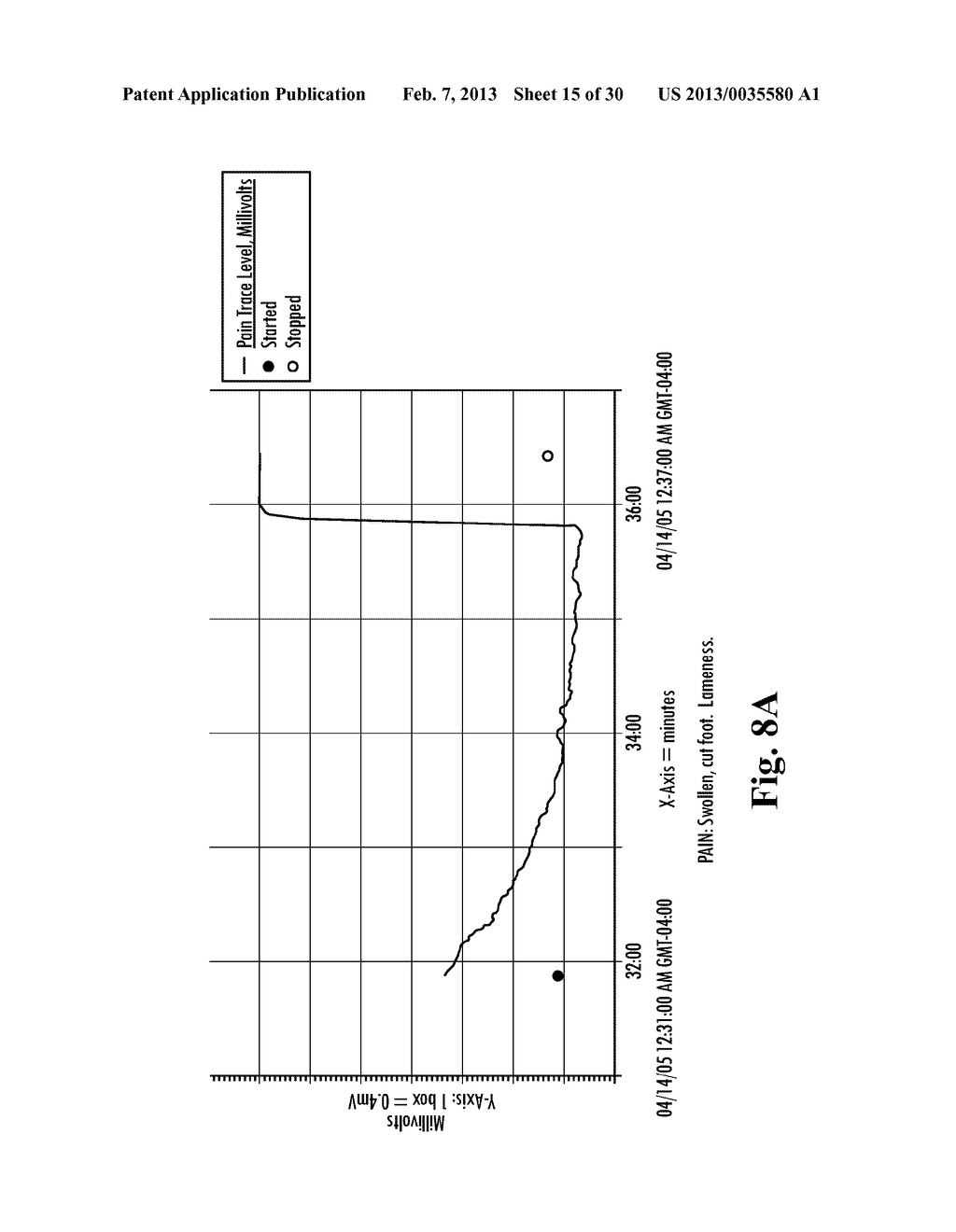 Measurement for Autonomic Function - diagram, schematic, and image 16