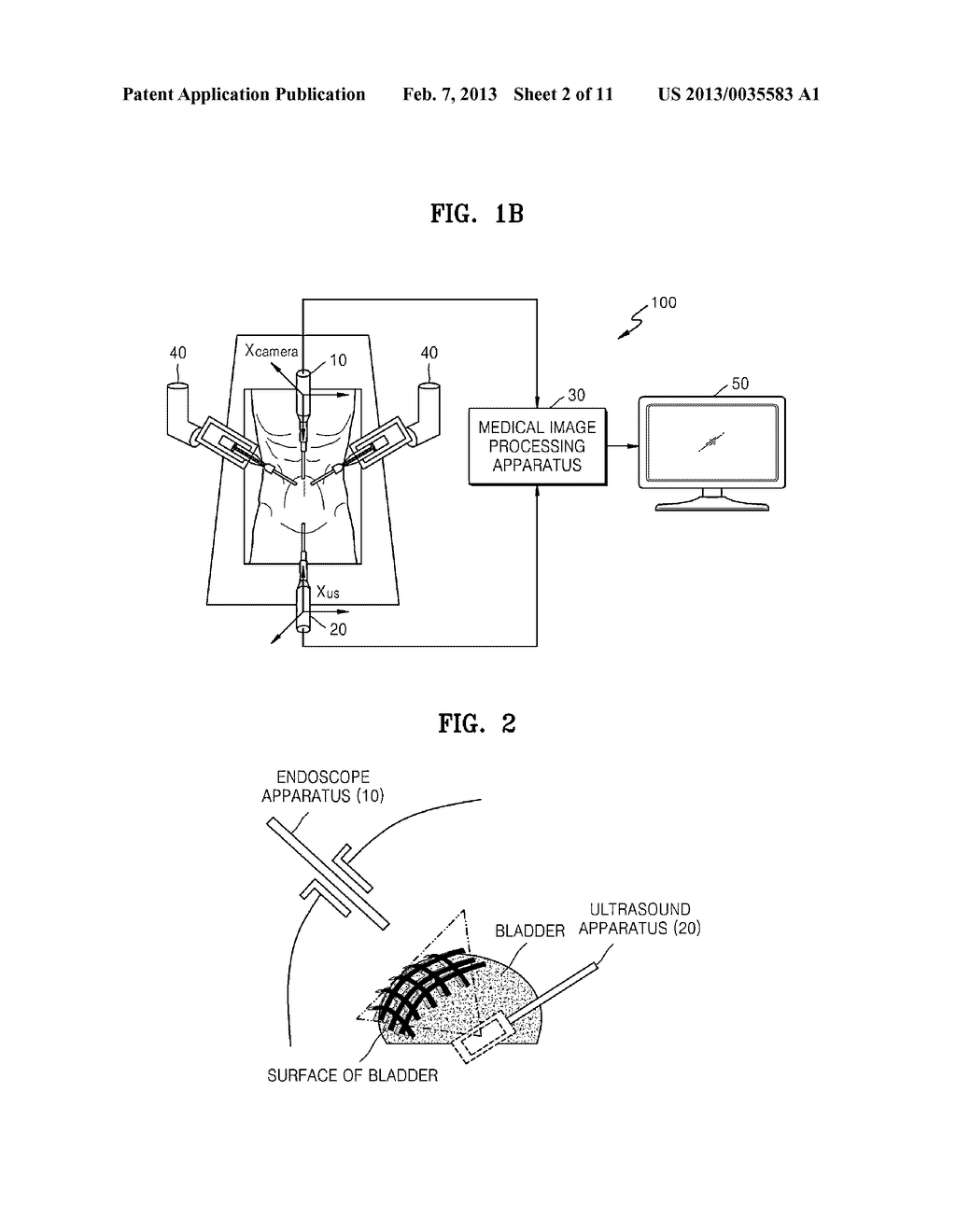 METHOD AND APPARATUS FOR PROCESSING MEDICAL IMAGE, AND ROBOTIC SURGERY     SYSTEM USING IMAGE GUIDANCE - diagram, schematic, and image 03