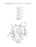 INSTRUMENT GUIDING DURING MAGNETIC RESONANCE IMAGING diagram and image