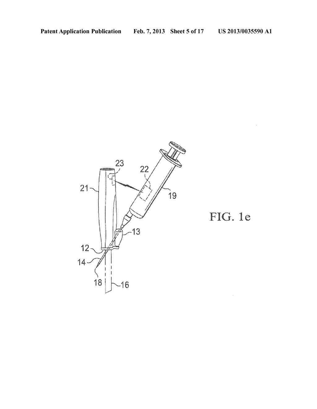 SYSTEMS AND METHODS TO ASSIST WITH INTERNAL POSITIONING OF INSTRUMENTS - diagram, schematic, and image 06